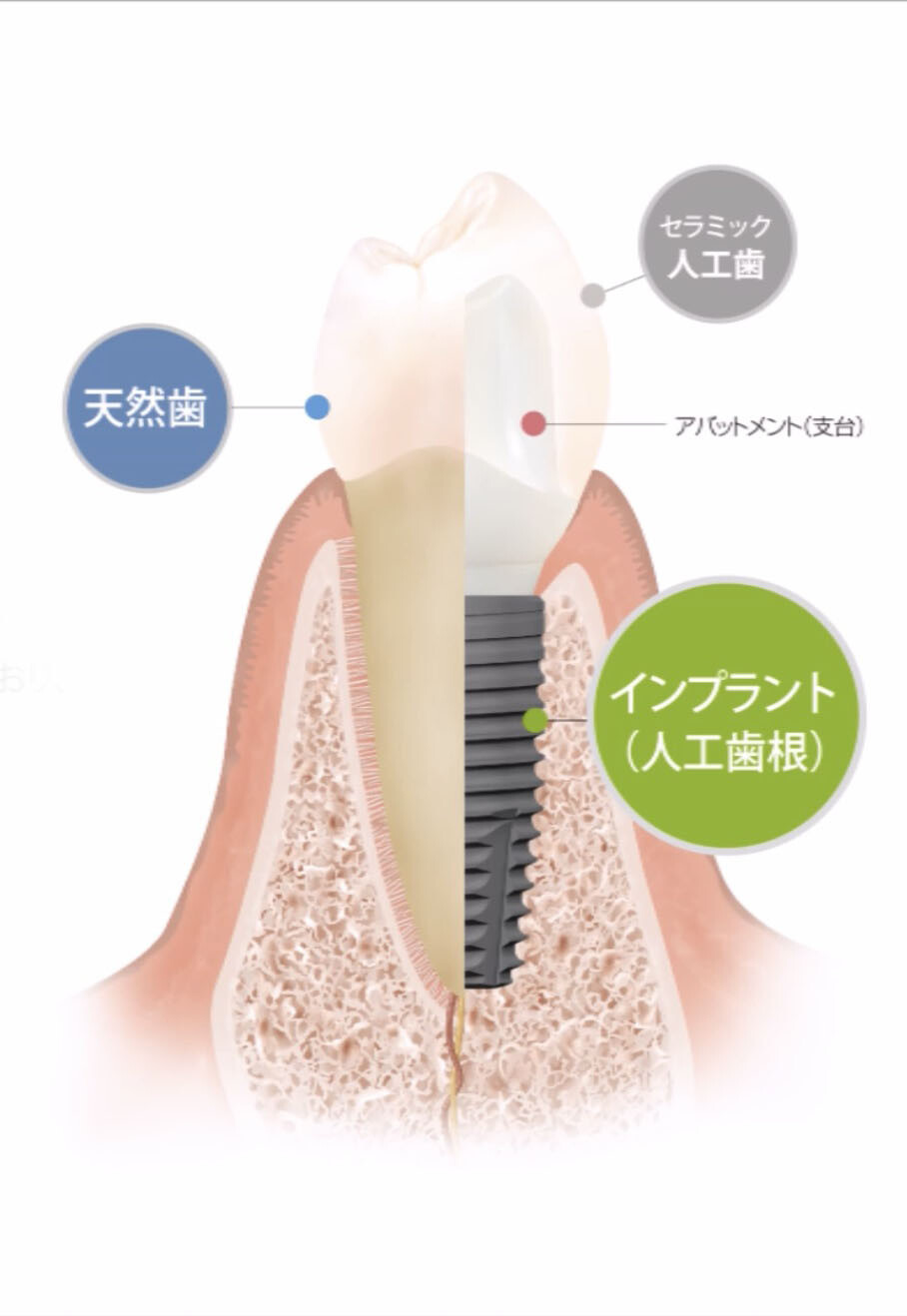 今お使いの入れ歯でこんなお悩みはありませんか？